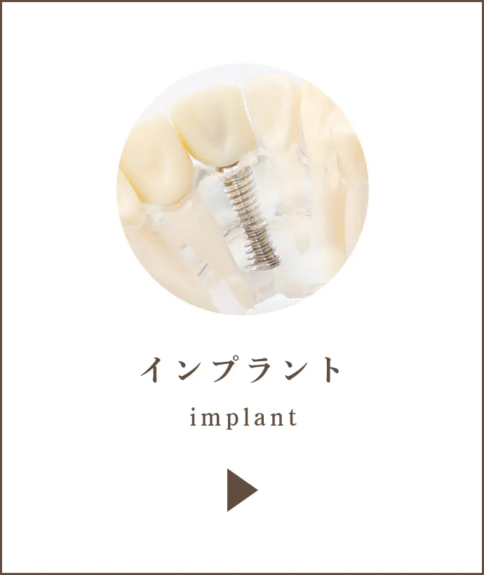 インプラント